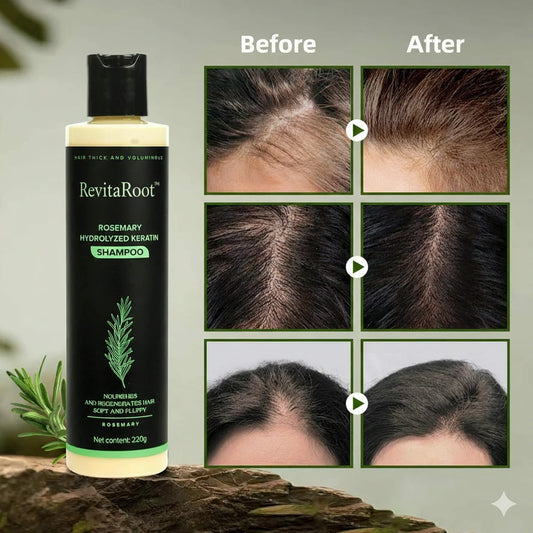 RevitaRoot™ Rosemary Shampoo for Fuller, Healthier-Looking Hair