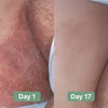 Veloma Antifungal Soap
