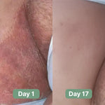 Veloma Antifungal Soap
