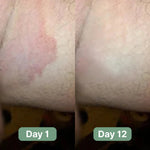 Veloma Antifungal Soap